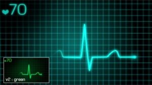 دانلود فوتیج موشن گرافیک مانیتور ضربان قلب EKG Monitor